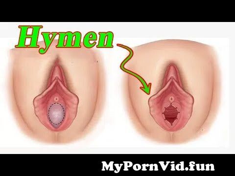 Hymen Video