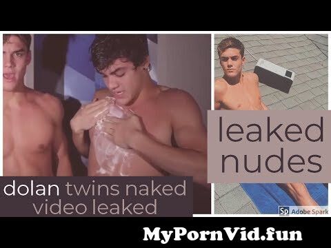 Dolan twins nudes leaked