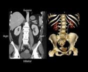 Yale Radiology and Biomedical Imaging