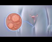 Nucleus Health Videos - Español