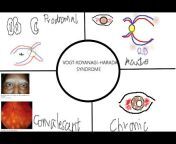 Ophthalmology revision