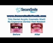 Secure Smile Teeth from teeth