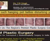 Dr. V.D. Singh - Tummytuck Surgery Center in Chandigarh, Punjab, India offers quality treatment to get rid of belly fat. Abdominoplasty or Tummy tuck by the hands of Dr. V.D. Singh can help you achieve your desired look.nhttp://www.tummytuck-chandigarh.com/