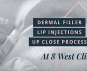 Vancouver patient Yvonne gets a subtle lip augmentation with dermal filler lip injections at 8 West Clinic to give her face a natural-looking boost of volume. See her treatment with one of our skilled RN injectors up close.nn★ HELPFUL RESOURCES FOR YOU ★n→ Lip Injections 101: https://www.8west.ca/non-surgical/dermal-fillers/n→ Request a FREE injectables consultation at Vancouver&#39;s 8 West Clinic: https://www.8west.ca/contact-us/