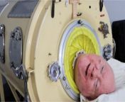 USA: Man who lived with an 'iron lung' due to polio dies aged 78 from swathi naidu with iron man