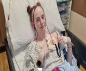 A young woman with a paralysed stomach hasn&#39;t been able to eat or drink anything for eight years - and is fed through her heart to survive. &#60;br/&#62;&#60;br/&#62;Liv Rose, 25, has struggled with stomach pain since the age of three but says doctors dismissed it as &#39;tummy ache&#39;.&#60;br/&#62;&#60;br/&#62;She struggled to eat anything other than bland foods - such as plain pasta or chicken.&#60;br/&#62;&#60;br/&#62;Liv began vomiting undigested food but says her symptoms were dismissed for an eating disorder at first.&#60;br/&#62;&#60;br/&#62;She was finally diagnosed with gastroparesis - when food passes through the stomach slower than it should - and pan-gut dysmotility - where the gut does not work as it should.&#60;br/&#62;&#60;br/&#62;Now Liv has a Hickman line which goes directly into her heart so she can receive nutrition.