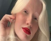 Credit: SWNS / Fleur Van Der Ven&#60;br/&#62;&#60;br/&#62;A woman bullied for being albino has embraced her pale skin and white hair and says kids now often mistake her for Elsa from Frozen. &#60;br/&#62;&#60;br/&#62;Fleur Van Der Ven, 20, didn&#39;t realise she was different until she was seven and other children started to avoid her - cruelly calling her a vampire and a ghost. &#60;br/&#62;&#60;br/&#62;She claims she was picked on for her appearance - which left her dyeing her locks dark brown and coating her white eyelashes in black mascara.&#60;br/&#62;&#60;br/&#62;But at the age of 15, Fleur learnt to embrace her albinism and stopped dyeing her hair and wearing a full face of make-up. &#60;br/&#62;