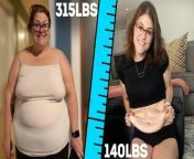 BASED in Florida, Megan’s relationship with food caused her to go through years and years of frustration and desperation. With food slowly becoming her “friend” and the only thing that made her feel good, it led to her gaining more and more weight, with her highest weight being 315lbs. Megan says: “If I didn’t do something about it I literally could have died.” The catalyst for her weight loss journey and mental shift came from her trip to Disney World, where she was unable to fit on most of the rides. This experience motivated her into believing that from this moment on, no matter what it took, she “had to start now” and by investing in herself, weight loss surgery and the support of her partner and Dad, she was able to lose 175lbs, leaving her in a state of amazement at her new body till this day.