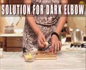 #blackelbow #skincare #fairskin&#60;br/&#62;In this video our very talented, beautiful TV and Movie Actress &amp; Heath &amp; beauty Expert Mrs Priyanka Saini is telling &#92;