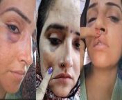 Seema Haider Viral Video: In the viral video, Seema is making a video showing her injury marks after being assaulted. In the video, Seema Haider is showing injury marks on her face and hands. &#60;br/&#62; &#60;br/&#62;Seema Haider Viral Video: वायरल वीडियो में सीमा अपने साथ मारपीट के बाद चोट के निशान दिखाते हुए वीडियो बना रही हैं. वीडियो में सीमा हैदर अपने चेहरे और हाथों पर चोट के निशान दिखा रही है. &#60;br/&#62; &#60;br/&#62;#SeemaHaider #Sachinmeena&#60;br/&#62;~HT.99~PR.115~ED.120~