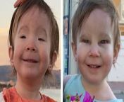 A toddler born visually impaired due to a rare condition can see clearly for the first time thanks to corrective surgery.&#60;br/&#62;&#60;br/&#62;Lily Etherton, two, suffers from Blepharophimosis Ptosis Epicanthus Inversus Syndrome (BPES), which means she couldn&#39;t open her eyes fully.&#60;br/&#62;&#60;br/&#62;Lily&#39;s condition meant she had droopy eyelids, smaller than average eye openings and an upward fold of the inner lower eyelid.&#60;br/&#62;&#60;br/&#62;As she grew older, the condition made it difficult for Lily to move, walk and function. &#60;br/&#62;&#60;br/&#62;Last month, Lily was operated on and underwent a frontalis flap surgery, which aimed at opening her eyes so she could see properly.